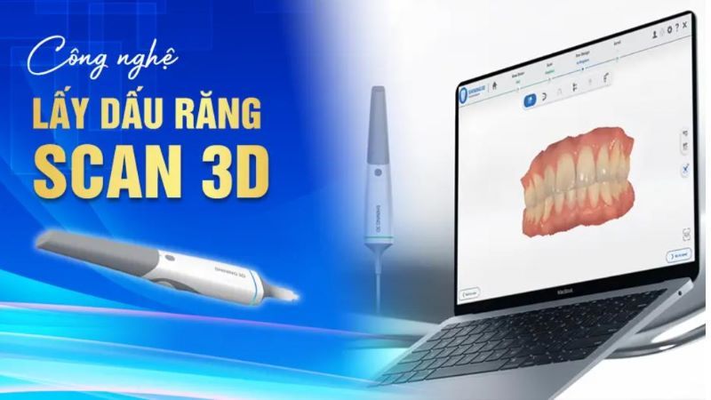 địa chỉ trồng răng implant tốt uy tín Phường Bình Phú TPHCM 3