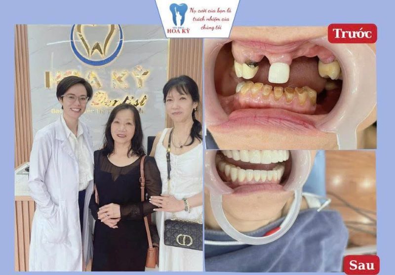 nha khoa uy tín xã Kim Long TPHCM