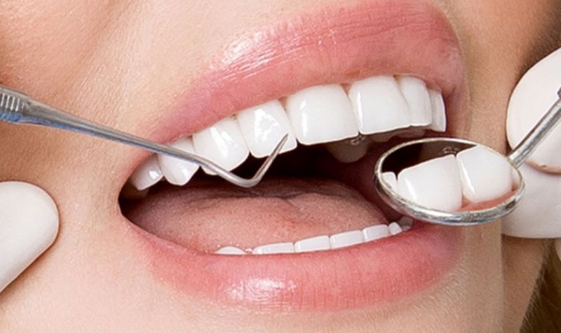 Nha Khoa Nhuận Phát nổi bật với dịch vụ phục hình răng sứ chất lượng