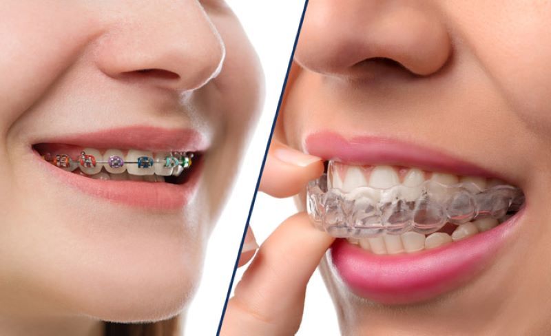 nha khoa uy tín xã Xuyên Mộc TPHCM