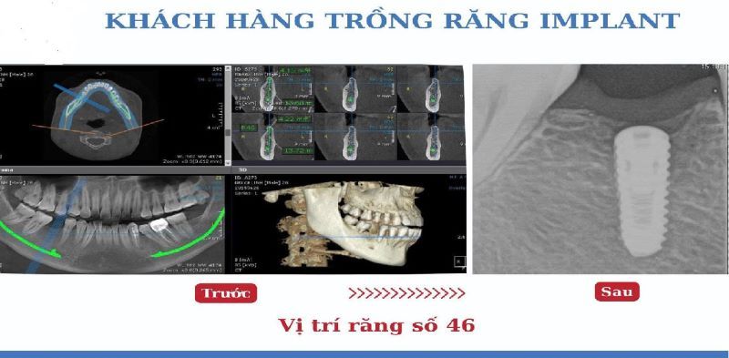 nha khoa uy tín xã Xuyên Mộc TPHCM 2