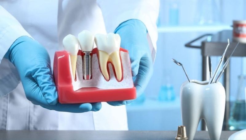 Nha Khoa Hạnh Phúc nổi bật với dịch vụ implant chất lượng cao 