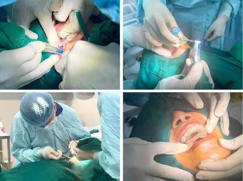 Bệnh viện An Sinh nổi bật dịch vụ Implant tiêu chuẩn
