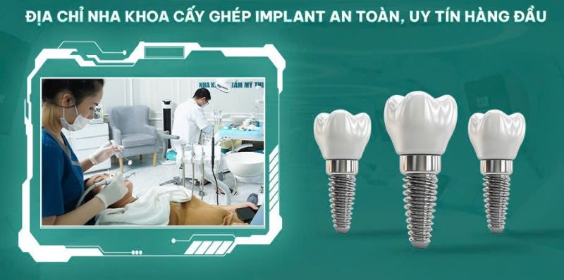 Nha Khoa Blossom ứng dụng Implant cao cấp chuẩn quốc tế