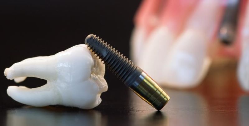 địa chỉ trồng răng implant tốt uy tín Phường Xuân Hòa TPHCM