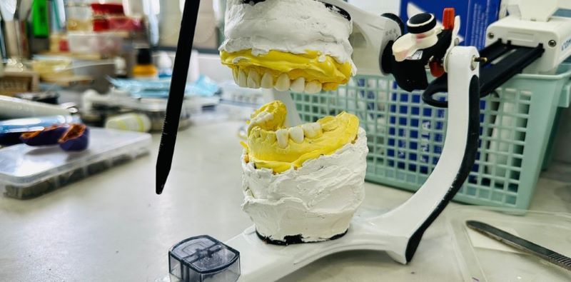 Nha Khoa Sakura nổi tiếng với kỹ thuật cấy implant an toàn, hiện đại