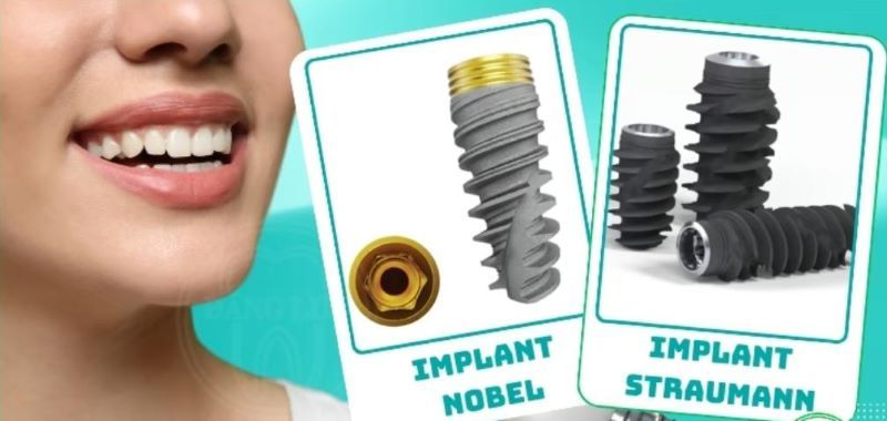 địa chỉ trồng răng implant tốt uy tín Phường Bình Đông TPHCM