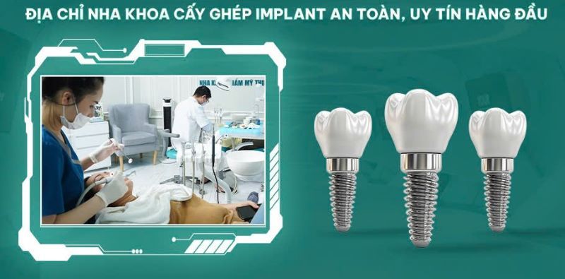 Nha khoa Kim – Địa chỉ trồng răng implant uy tín, an toàn cao