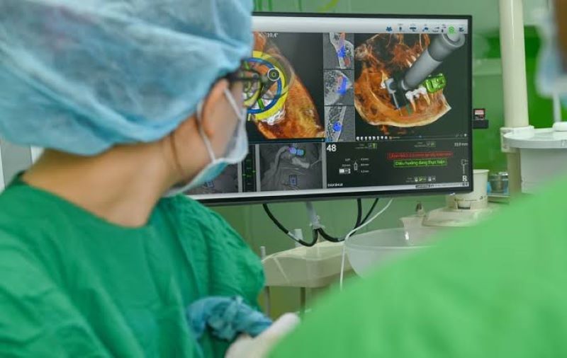 địa chỉ trồng răng implant tốt uy tín Phường Hòa Hưng TPHCM