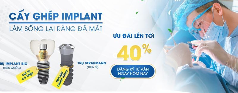 địa chỉ trồng răng implant tốt uy tín Phường Hòa Hưng TPHCM 2