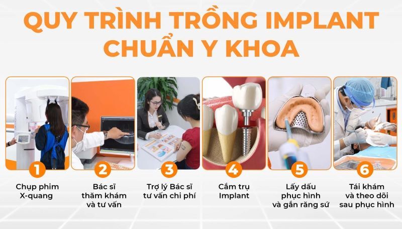 Nha khoa Tâm Như nổi bật quy trình Implant vô trùng chuẩn y khoa