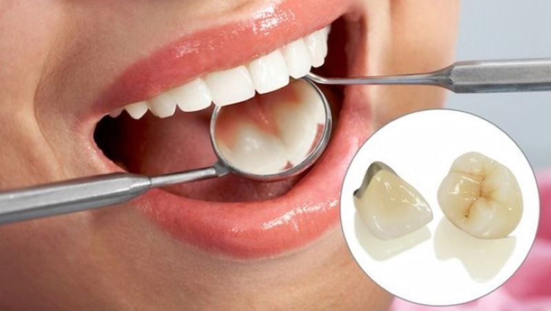 Dịch vụ nha khoa tổng quát tại TIMS