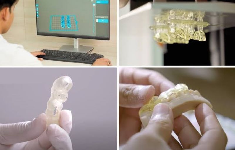 Nha Khoa Blossom ứng dụng Digital Implant và phòng Lab khép kín