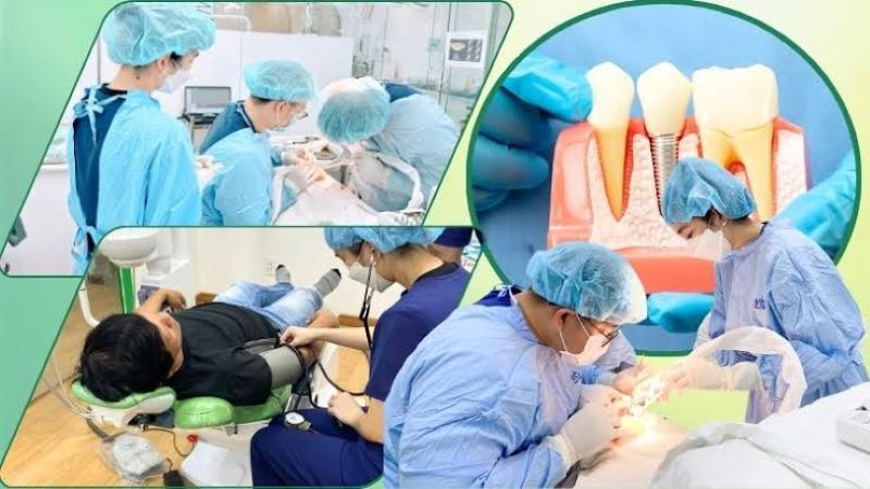 Nha khoa Đăng Lưu nhiều năm kinh nghiệm cấy ghép Implant