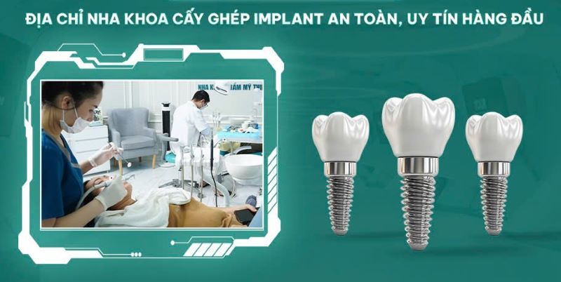 địa chỉ trồng răng implant tốt uy tín Phường An Phú Đông TPHCM