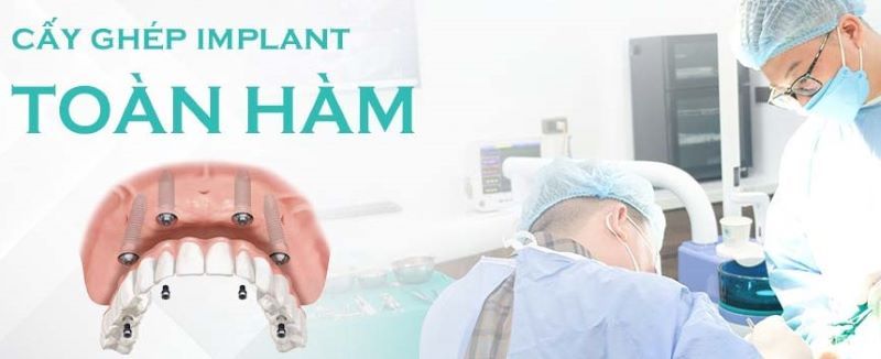 địa chỉ trồng răng implant tốt uy tín Phường An Phú Đông TPHCM 2