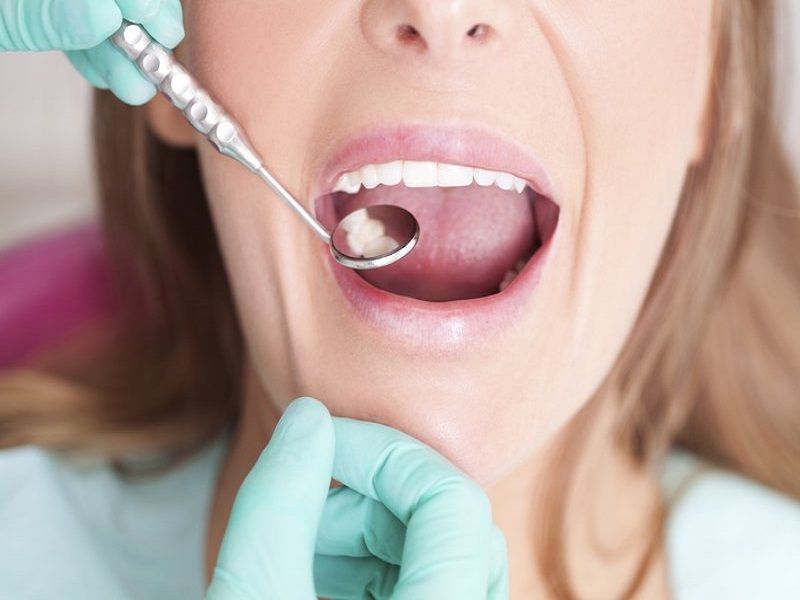 Dịch vụ chất lượng tại nha khoa Hoàn Hảo