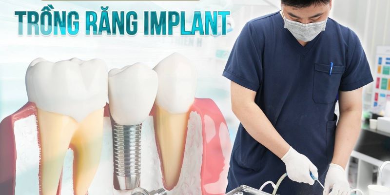 địa chỉ trồng răng implant tốt uy tín Phường Bình Tân TPHCM 2