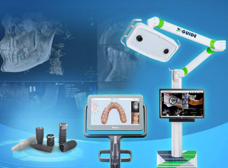 địa chỉ trồng răng implant tốt uy tín Phường Bình Tân TPHCM 7