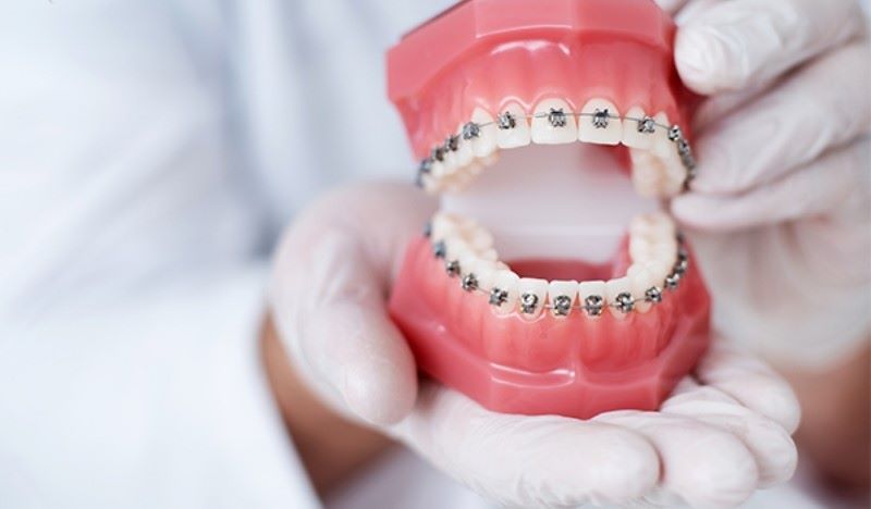 Kỹ thuật chuyên sâu tại nha khoa Flora