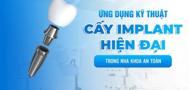 địa chỉ trồng răng implant tốt uy tín Phường Bình Trị Đông TPHCM 2