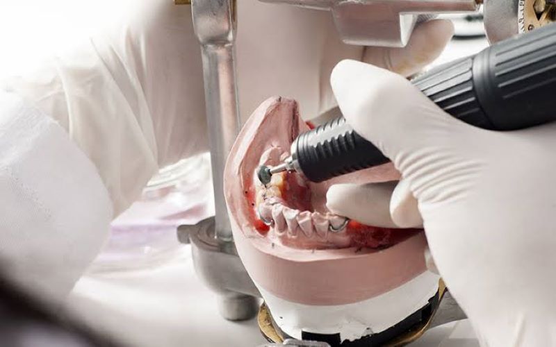 địa chỉ trồng răng implant tốt uy tín Phường Bình Hưng Hòa TPHCM 2