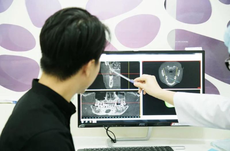 địa chỉ trồng răng implant tốt uy tín Phường Bình Hưng Hòa TPHCM 3