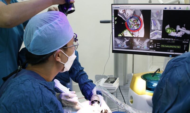 Nha khoa Lạc Việt Intech ứng dụng công nghệ X-Guide tiên tiến