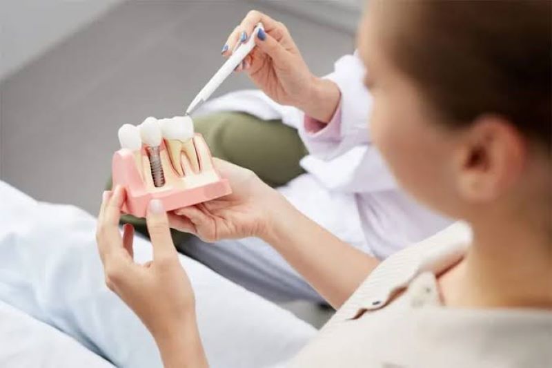 Nha khoa STONE có hơn 20 năm chuyên cấy ghép Implant