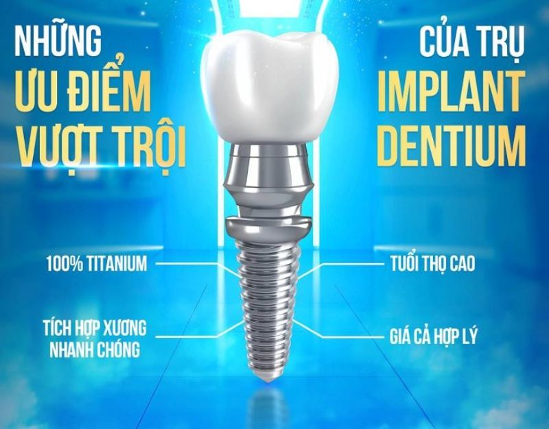 địa chỉ trồng răng implant tốt uy tín Phường Bình Lợi Trung TPHCM