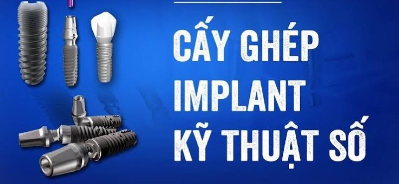 địa chỉ trồng răng implant tốt uy tín Phường Bình Lợi Trung TPHCM 3