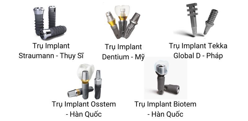 địa chỉ trồng răng implant tốt uy tín Phường Bình Lợi Trung TPHCM 4