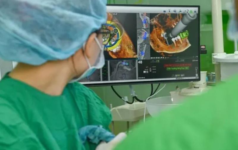 địa chỉ trồng răng implant tốt uy tín Phường Thạnh Mỹ Tây TPHCM 4
