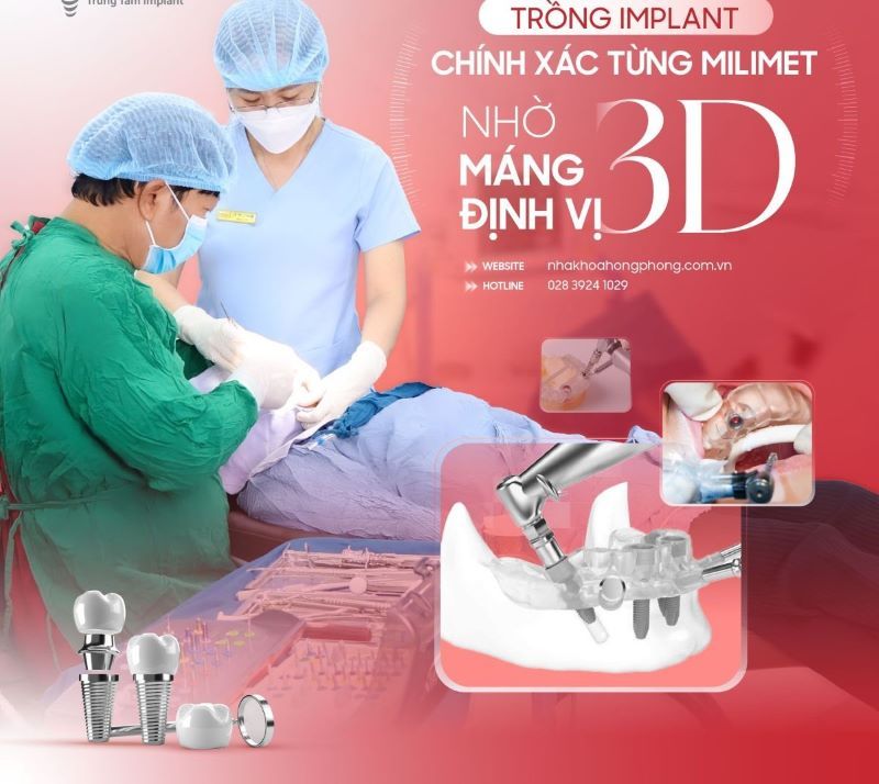 địa chỉ trồng răng implant tốt uy tín Phường Bình Quới TPHCM 4