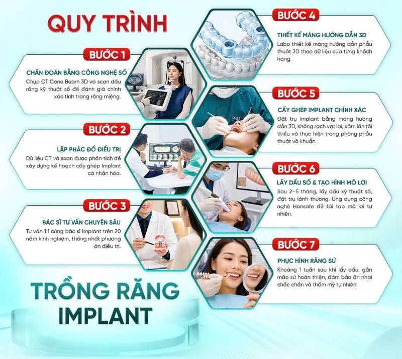 địa chỉ trồng răng implant tốt uy tín Phường Hạnh Thông TPHCM