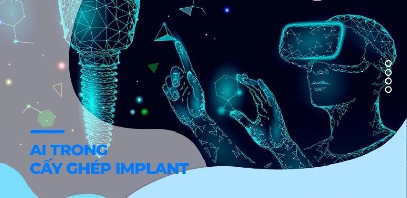 Nha Khoa Trồng Răng Sài Gòn thực hiện cấy ghép Implant có sự hỗ trợ của AI