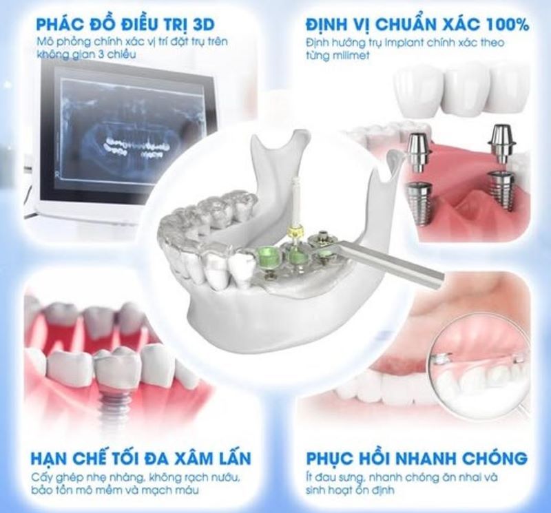 Thế Giới Implant là địa chỉ chuyên sâu trong công nghệ cấy ghép răng implant