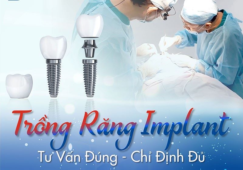 Nha khoa Đông Nam giàu kinh nghiệm trong lĩnh vực điều trị Implant