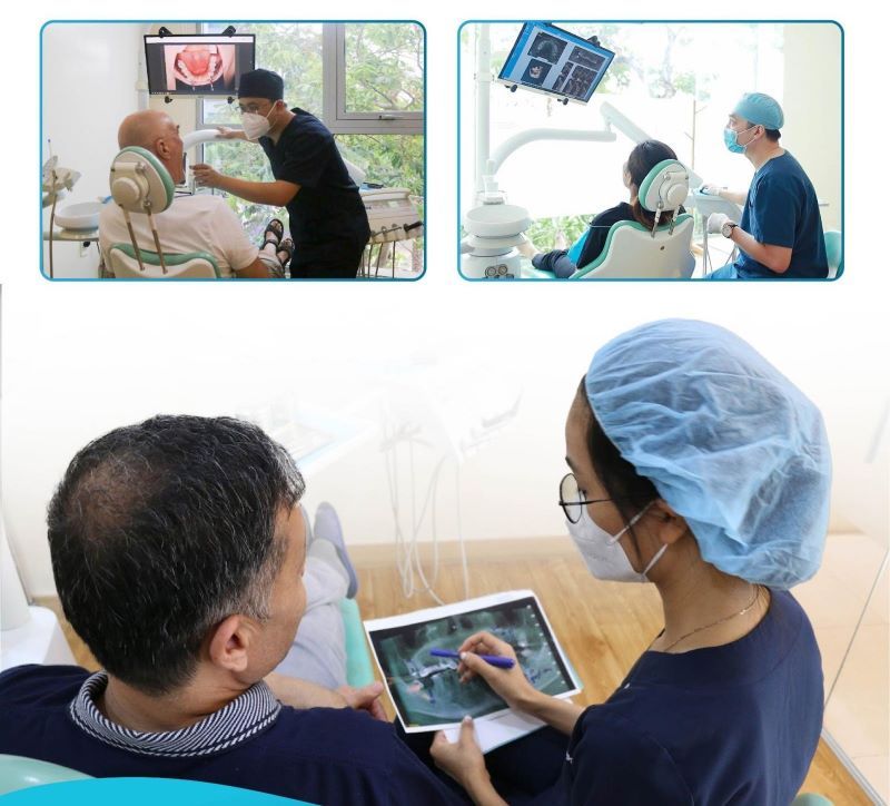 Nha khoa Dr.Care xây dựng phác đồ Implant theo từng trường hợp