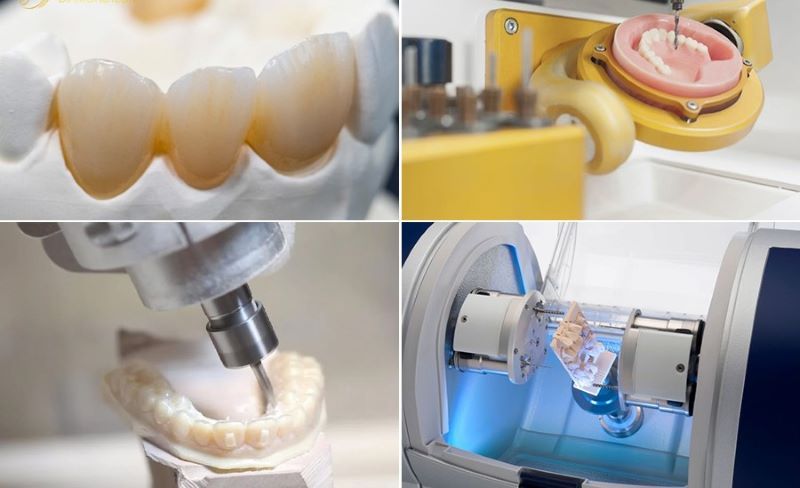 Phòng nha với thiết bị CAD/CAM và khu điều trị hiện đại