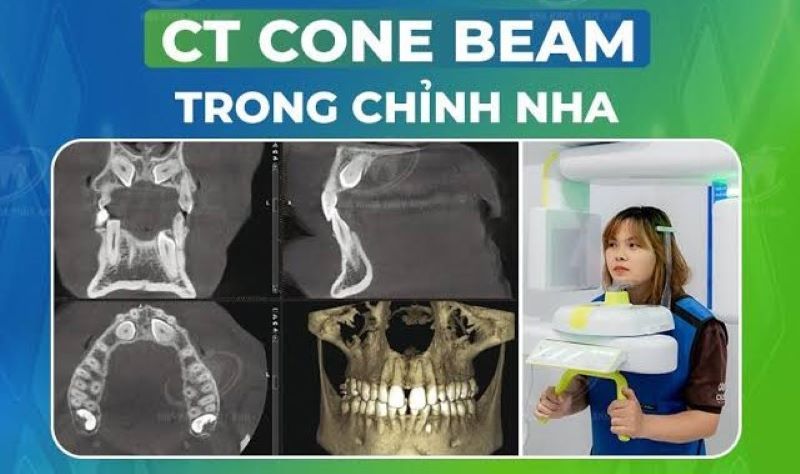 địa chỉ trồng răng implant tốt uy tín Phường Thông Tây Hội TPHCM 4