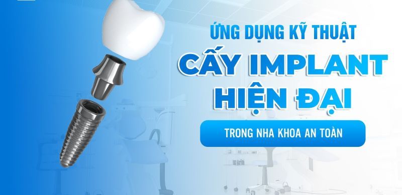 địa chỉ trồng răng implant tốt uy tín Phường An Hội Tây TPHCM
