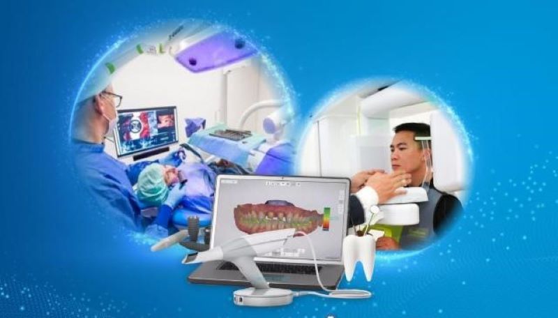 Công nghệ cấy ghép răng implant hiện đại tại Nha khoa Lạc Việt Intech