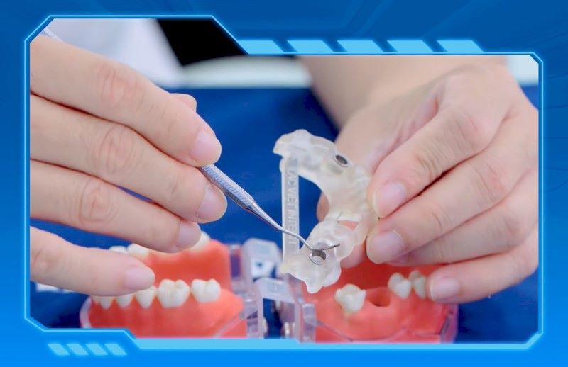 địa chỉ trồng răng implant tốt uy tín Phường Cầu Kiệu TPHCM