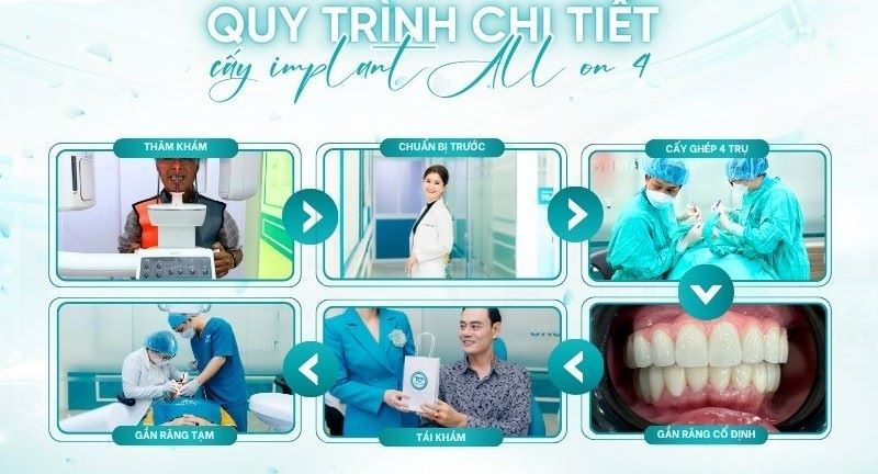 địa chỉ trồng răng implant tốt uy tín Phường Phú Nhuận TPHCM3
