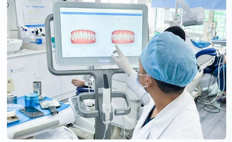địa chỉ trồng răng implant tốt uy tín Phường Tân Sơn Nhất TPHCM 5
