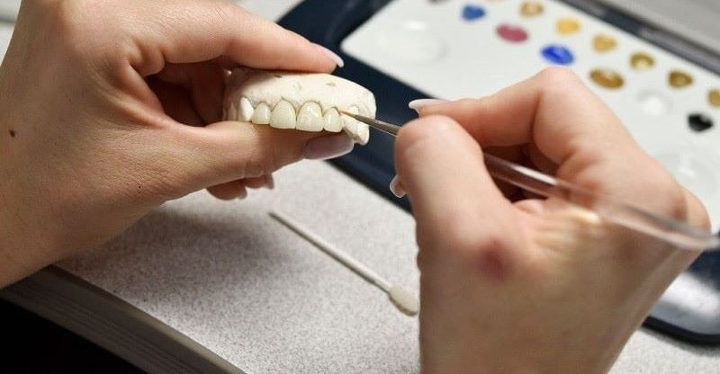 Kỹ thuật phục hình thẩm mỹ răng tại Nha khoa Như Ngọc