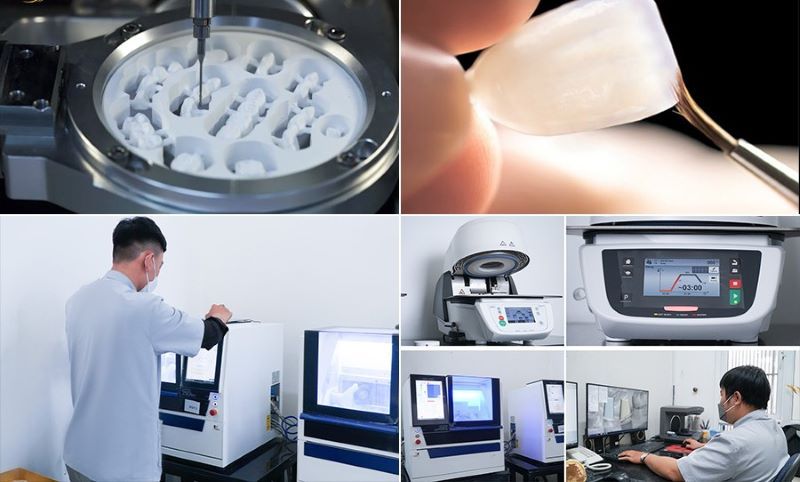 Phòng khám Nha khoa Ân Tâm với thiết bị CAD/CAM