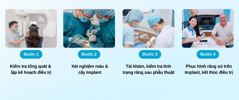 Nha khoa Trí Việt xây dựng quy trình phục hình implant chuyên nghiệp