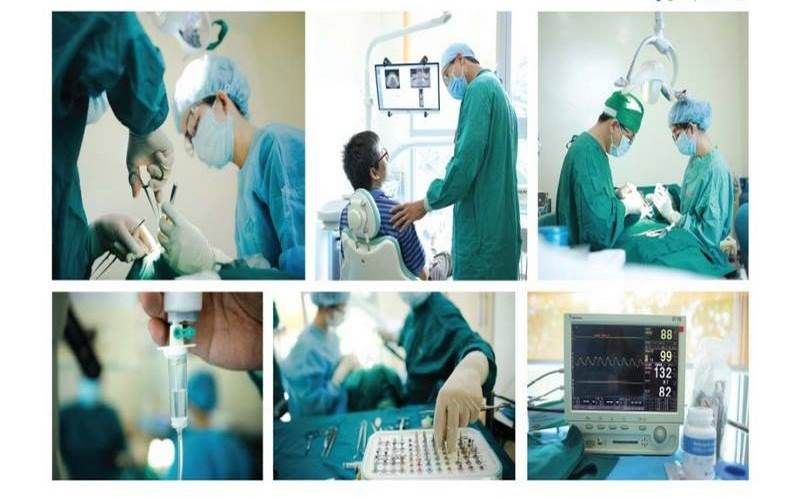 địa chỉ trồng răng implant tốt uy tín Phường Tân Sơn TPHCM 4